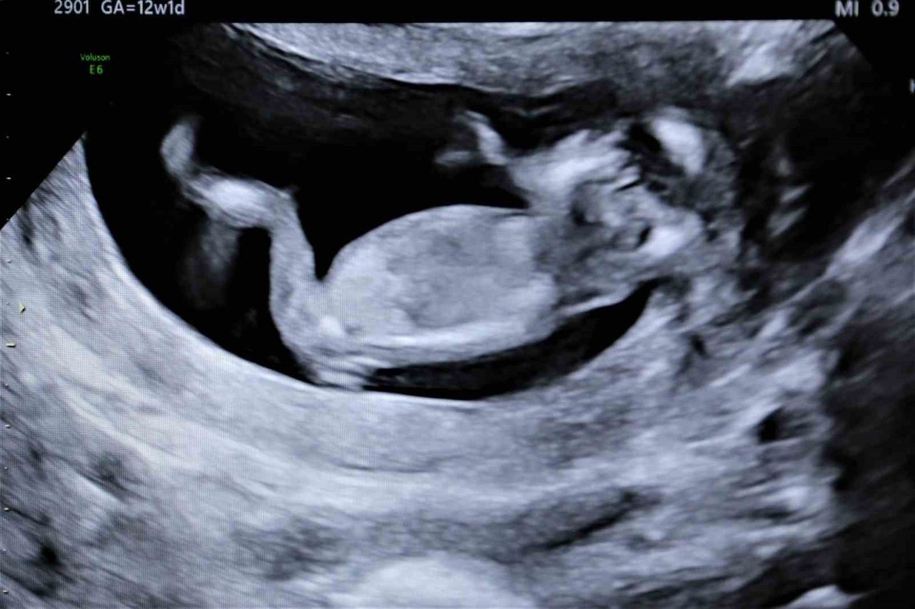 ’Gebelikte her balığın eti yenmez’ uyarısı