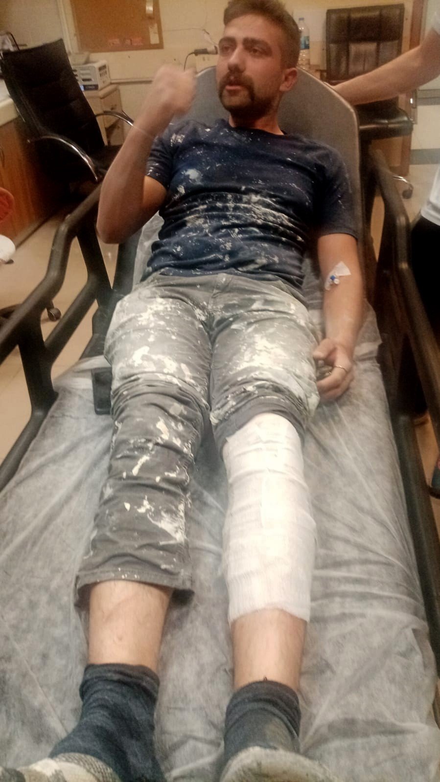 Sokak köpekleri iki kişiyi yaraladı