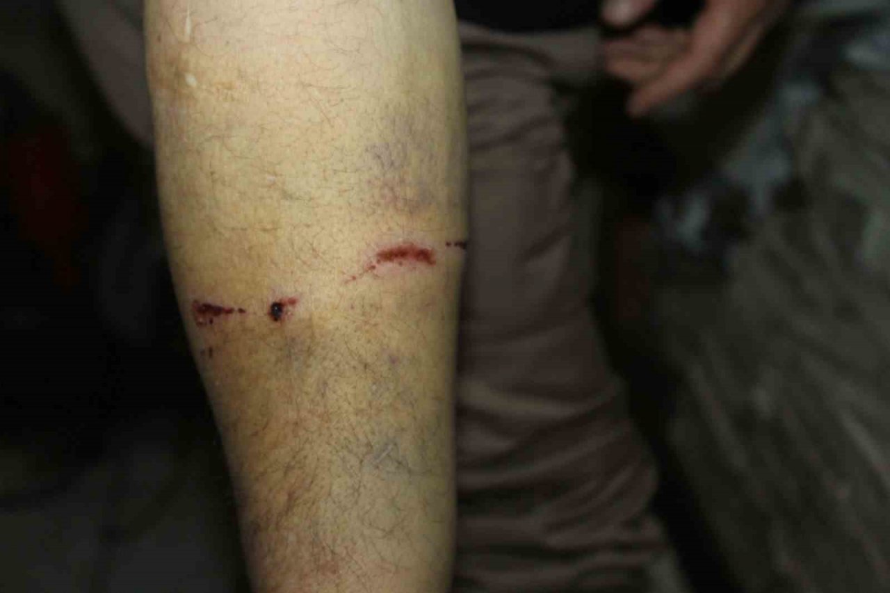 Sokak köpeğinin saldırdığı vatandaş yaralandı