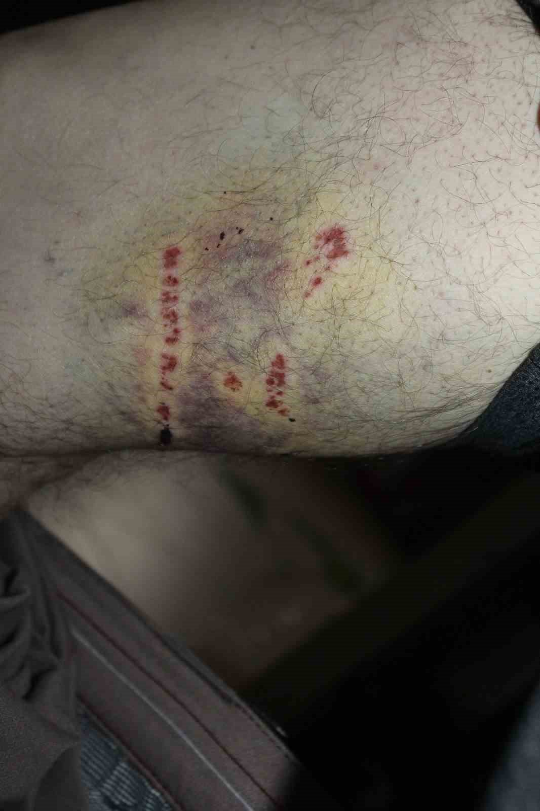 Sokak köpeğinin saldırdığı vatandaş yaralandı