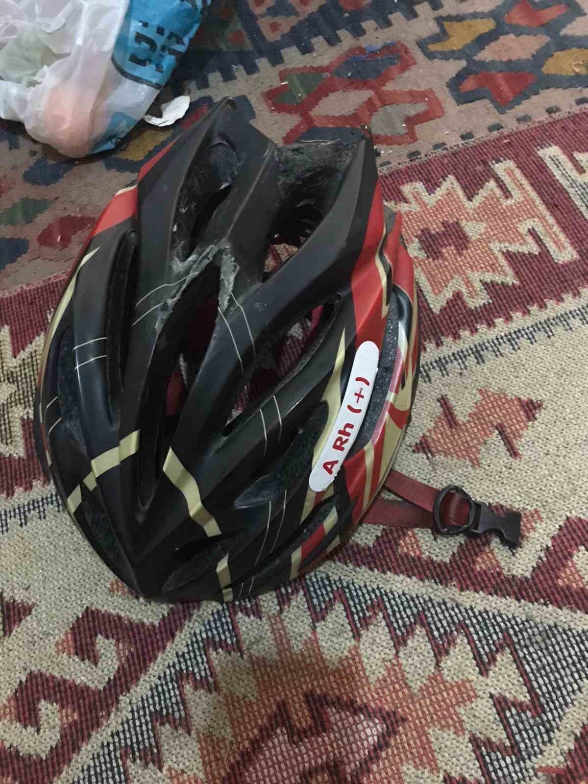 İstanbul’da korkunç cinayet: Beyzbol sopasıyla öldürüp cesedini yaktı