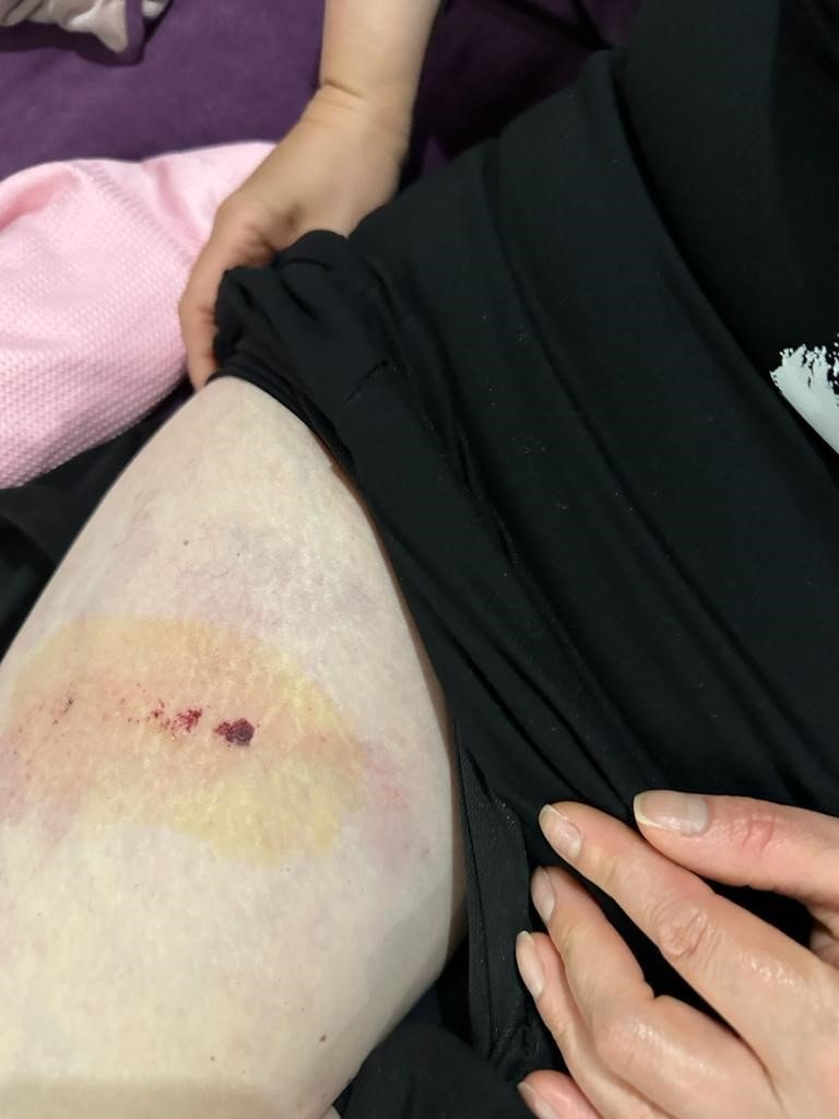 Metrelerce yükseklikten kopan beton parça üzerlerine düştü: 2 yaralı