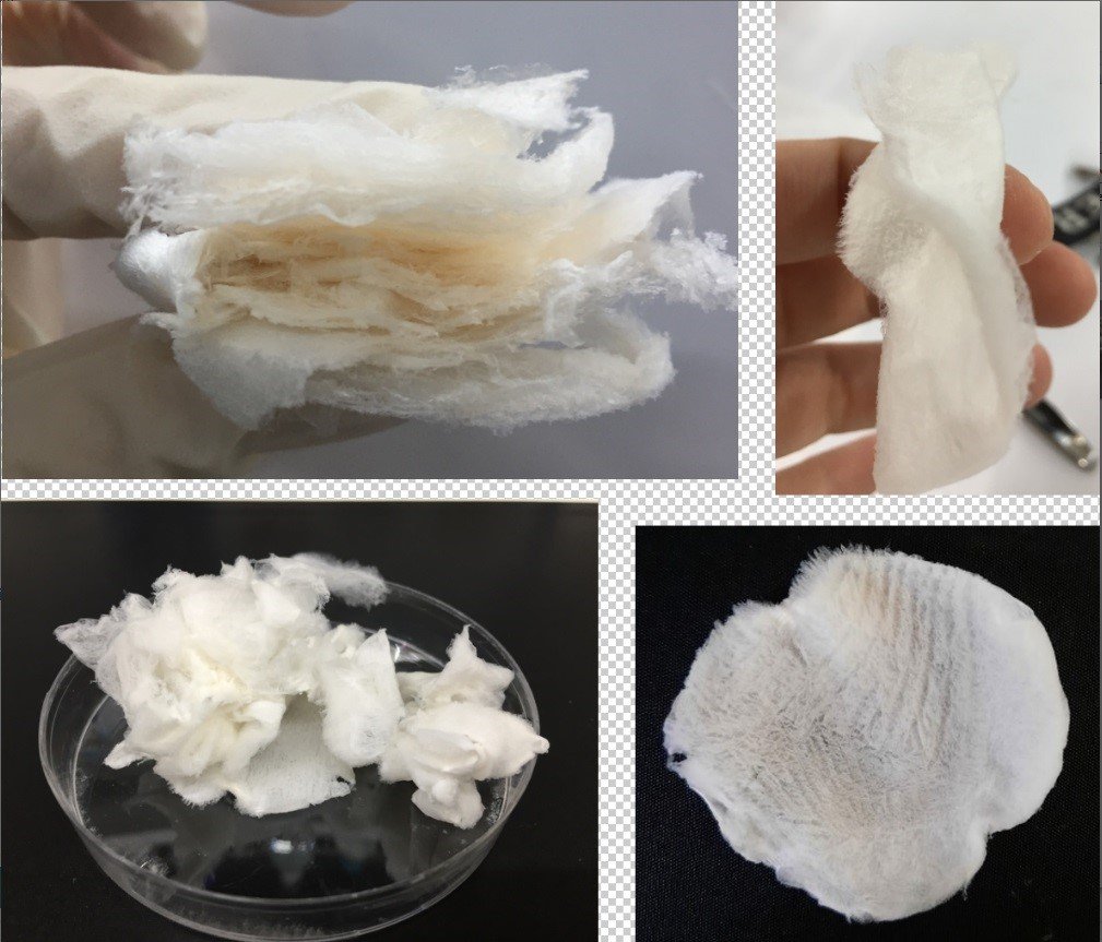 BTÜ’lü araştırmacılar o hastalığa çare oluyor