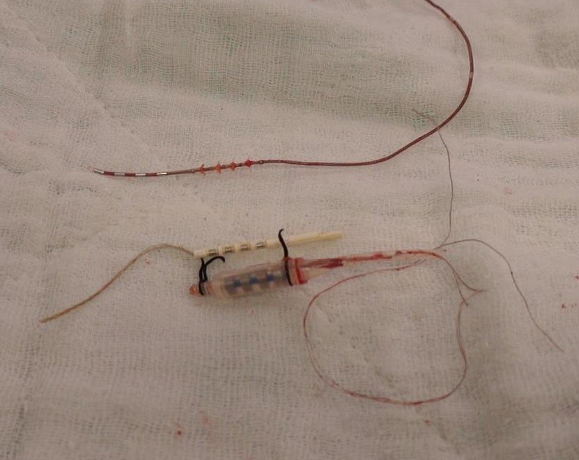 Doç. Dr. Ahmet Karakeçi; “Mesane pili yöntemi oldukça güvenli bir yöntemdir”