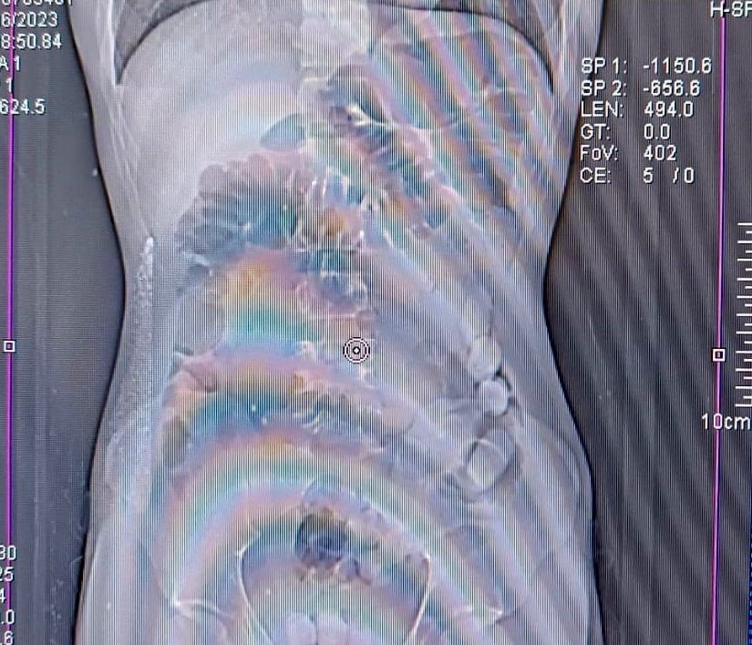 Midede uyuşturucu sevkiyatı