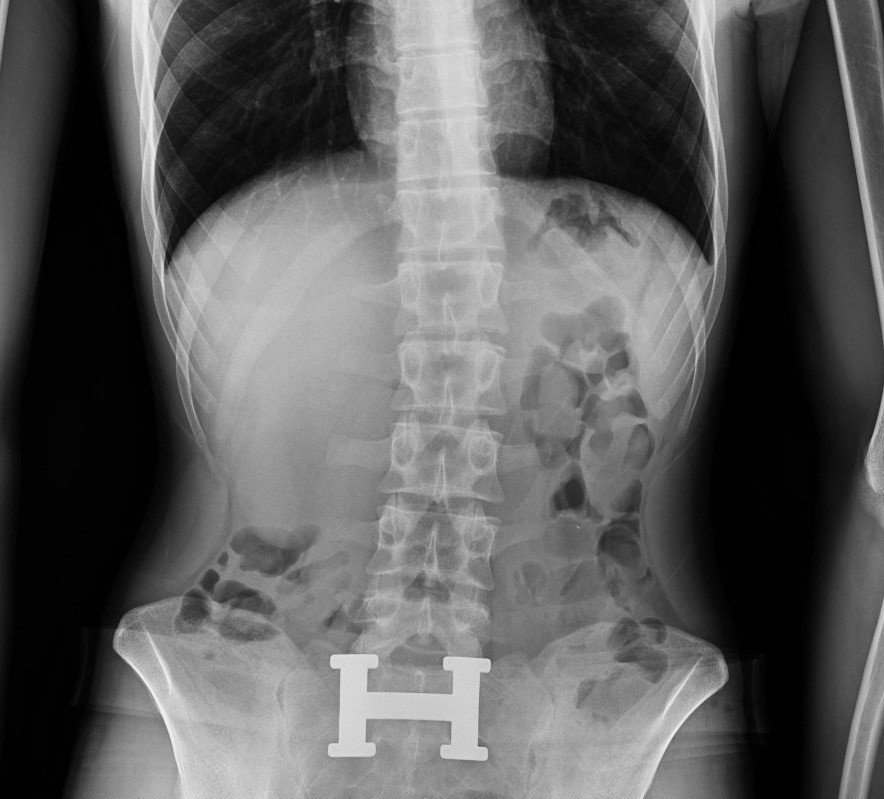 Diyarbakır’da 4 kişinin sindirim sisteminden 840 gram eroin ele geçirildi: 4 kişi tutuklandı