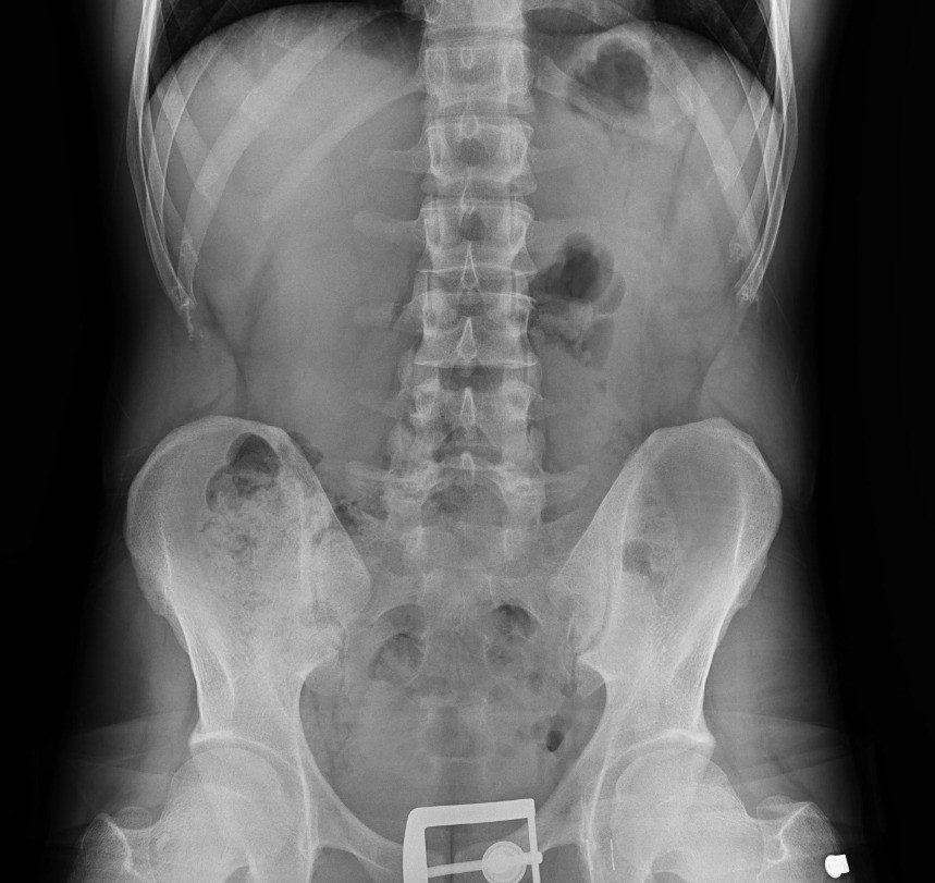 Diyarbakır’da 4 kişinin sindirim sisteminden 840 gram eroin ele geçirildi: 4 kişi tutuklandı