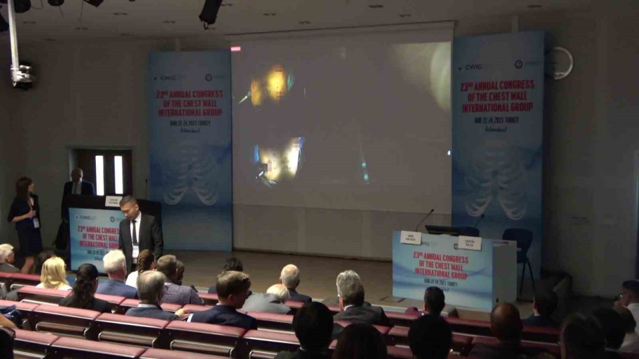 Yurtdışından gelen hekimler, İstanbul’da Pektus kongresine katıldı