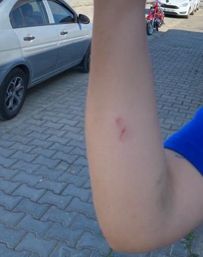 Yolda yürüyen genç kızlara dehşeti yaşattılar