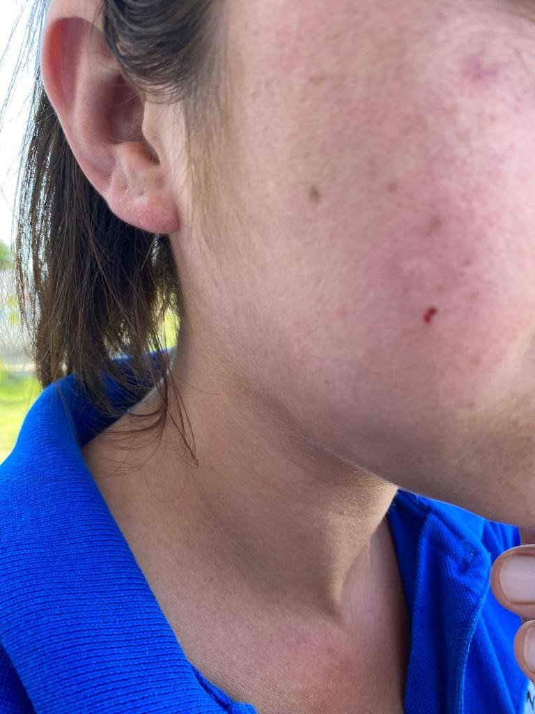 Yolda yürüyen genç kızlara dehşeti yaşattılar