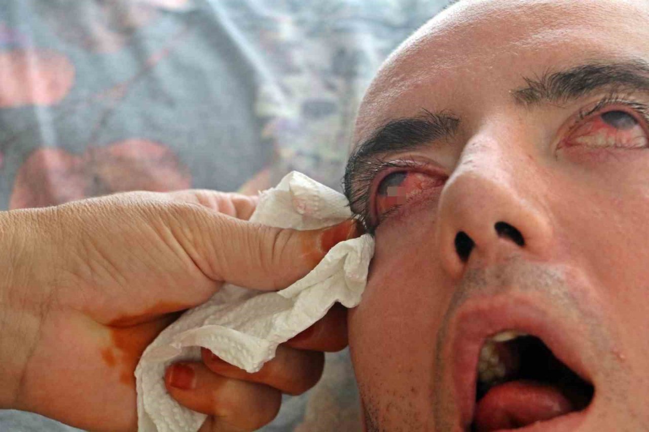 Doktorlar 6 ay ömür biçti, 10 yıldır gözlerini bir an olsun kırpmadan yaşam savaşı veriyor