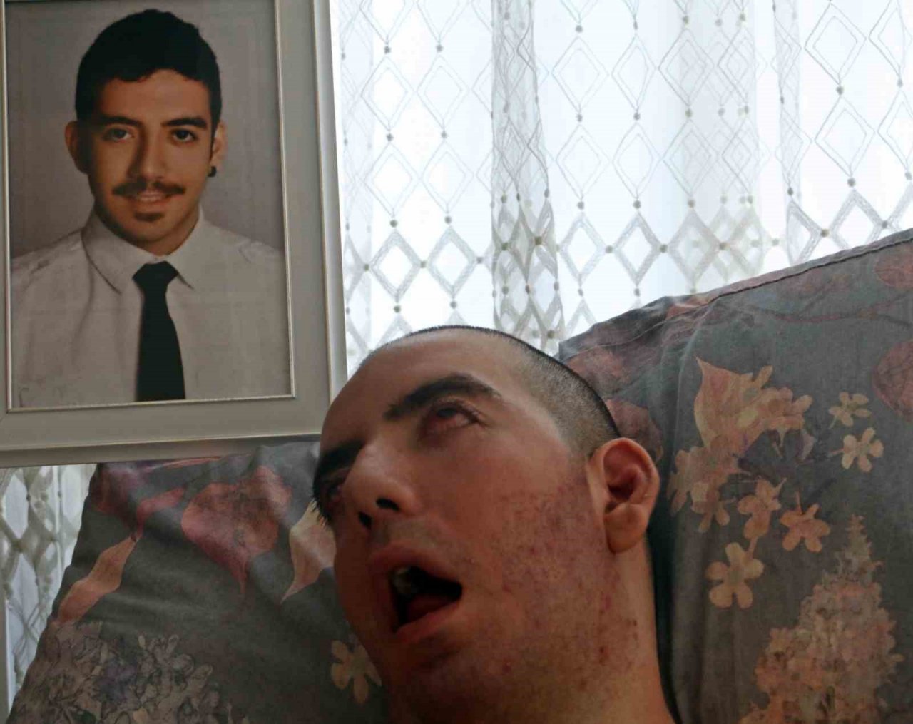 Doktorlar 6 ay ömür biçti, 10 yıldır gözlerini bir an olsun kırpmadan yaşam savaşı veriyor