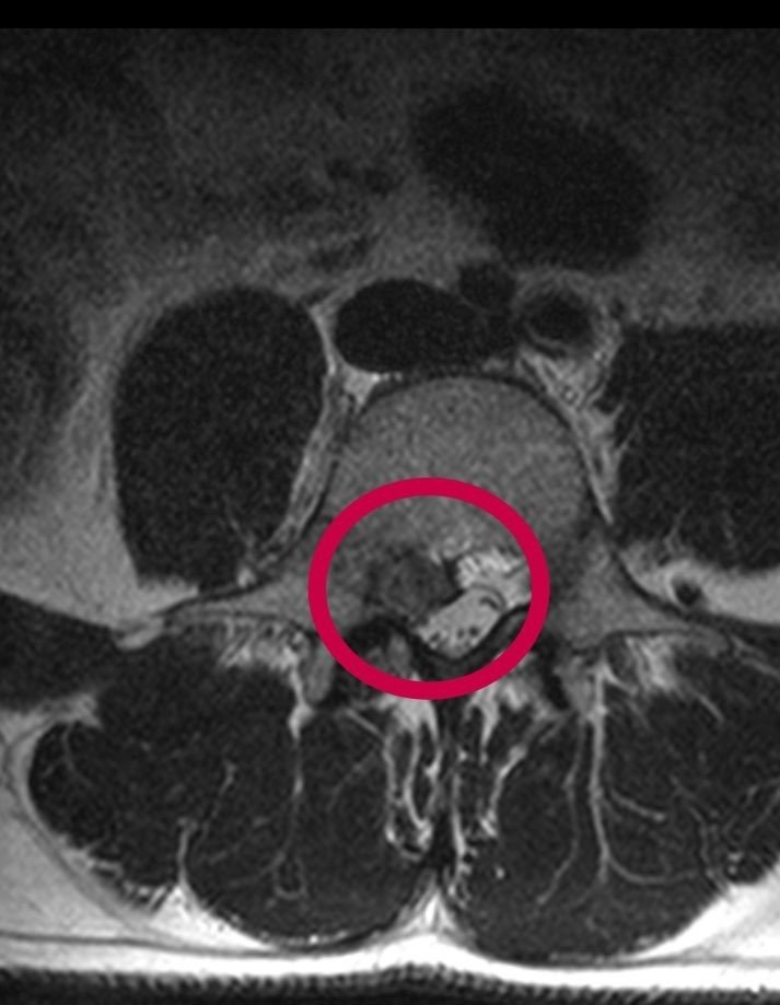 Şifayı Türkiye’de buldu