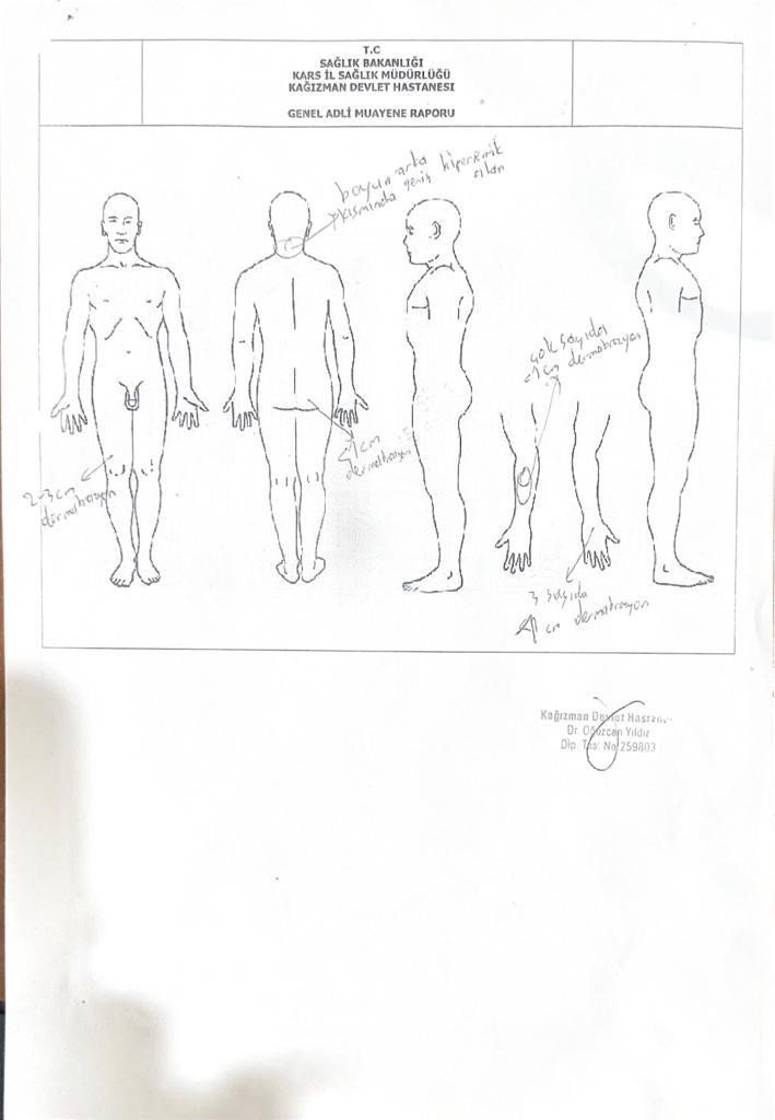 Kars’ta gazeteciye çirkin saldırı