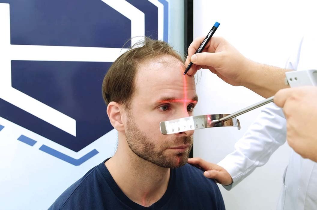 Dünyanın en iyi saç ekim merkezleri İstanbul’da