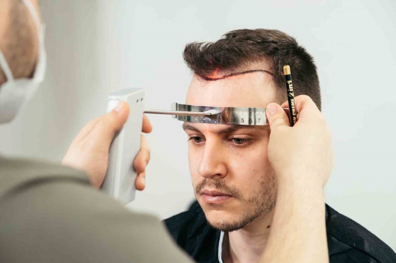 Dünyanın en iyi saç ekim merkezleri İstanbul’da