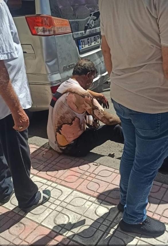 Diyarbakır’da aydınlatma panosunda patlama: 2 yaralı