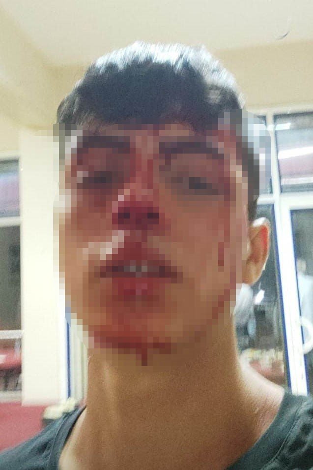 17 yaşındaki çocuğun başına silah dayayıp öldüresiye dövdüler