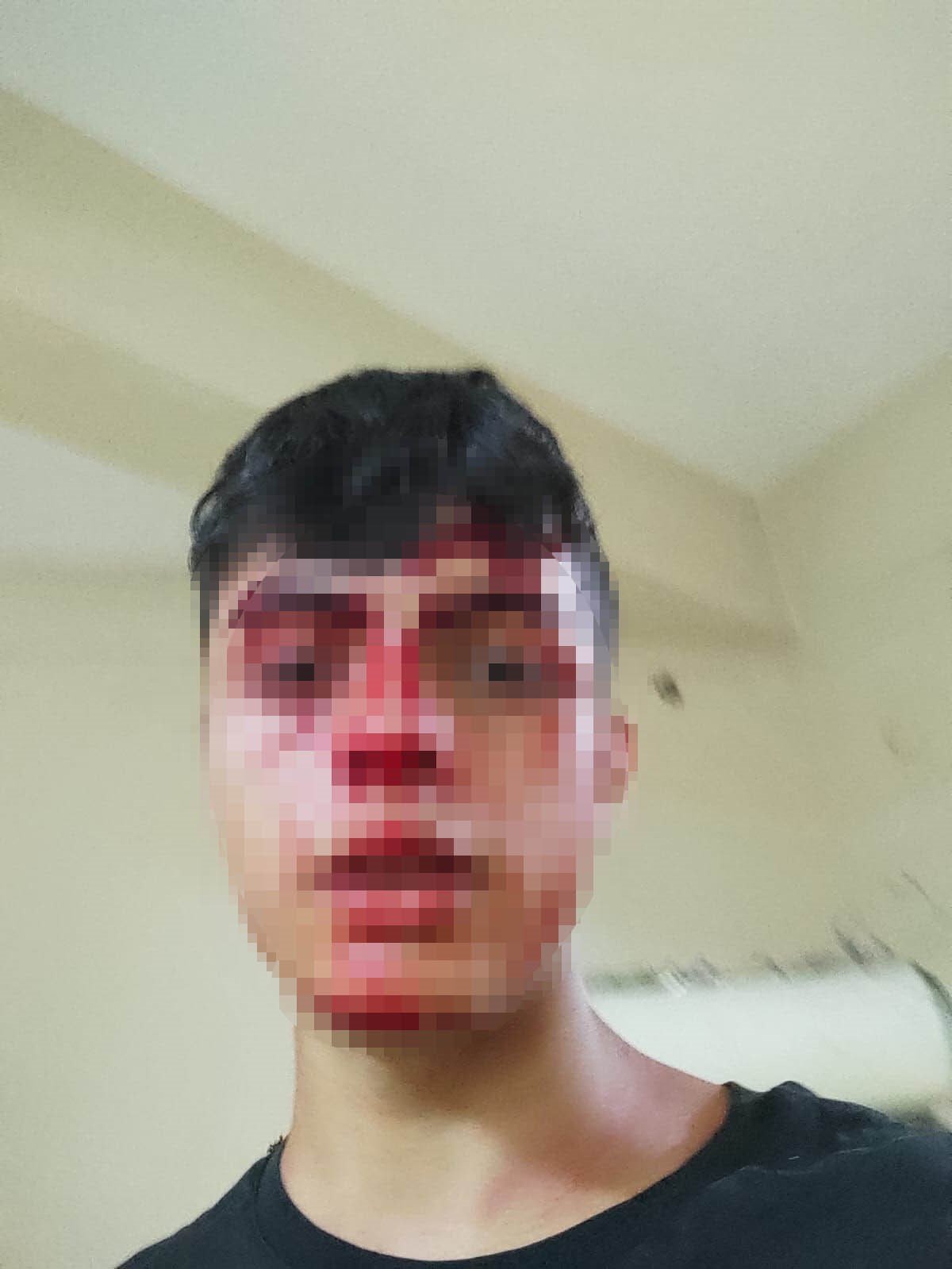 17 yaşındaki çocuğun başına silah dayayıp öldüresiye dövdüler