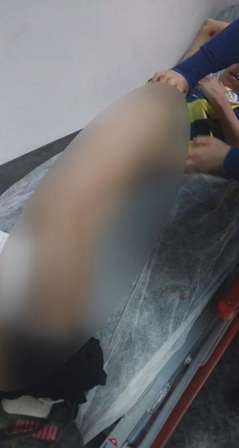 Köpeklerin saldırdığı 13 yaşındaki çocuk ölümden döndü