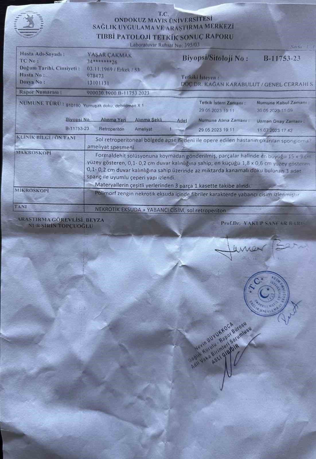 18 yıl boyunca karnında ameliyatta unutulan 3 parça gazlı bezle yaşadı