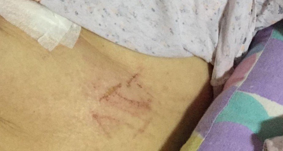 Yanlış yumurtalığı alınan kadına küstah cevap: “Bikini de giymeyiver"