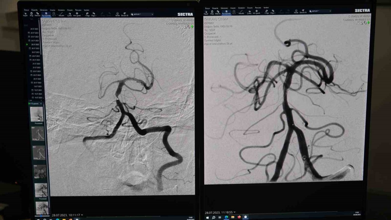 Sivas’ta ilk kez yapıldı, başarı sağlandı