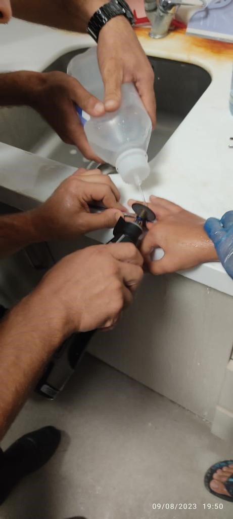 Çocuğun parmağına sıkışan yüzük, itfaiye ekipleri tarafından çıkarıldı