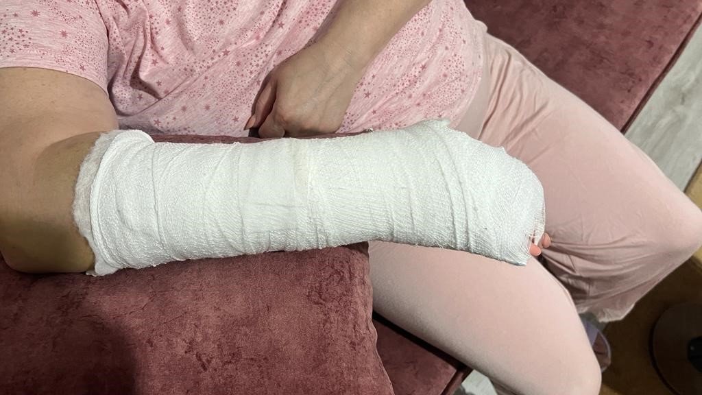 Bileği kırılan Ukraynalı kadından 44 bin 555 TL’lik alçı faturası itirazı