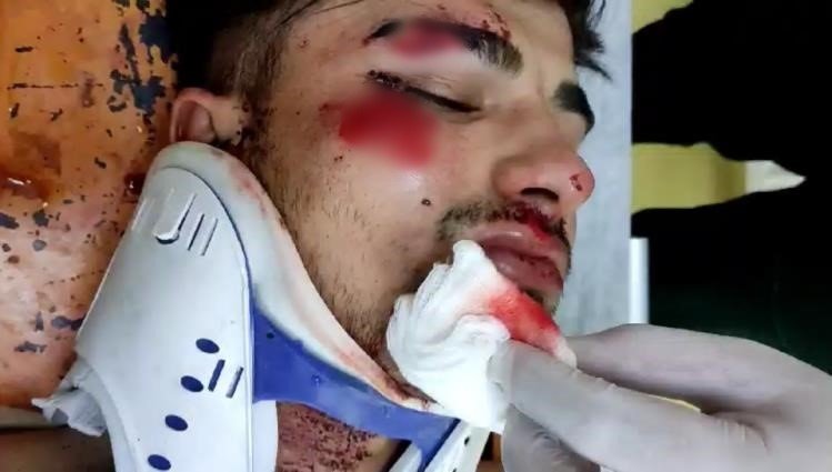 Patnos’ta ehliyetsiz motosiklet sürücüsü polis aracına çarptı