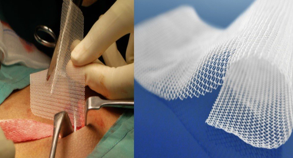 BUÜ’lü akademisyenin projesi “fıtık” oluşumunu engelleyecek