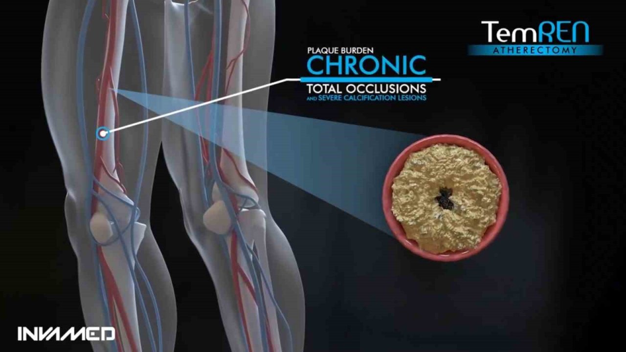 INVAMED’den tıbbi cihaz sektöründe yapay zeka ve uzaktan bağlantı teknolojisi