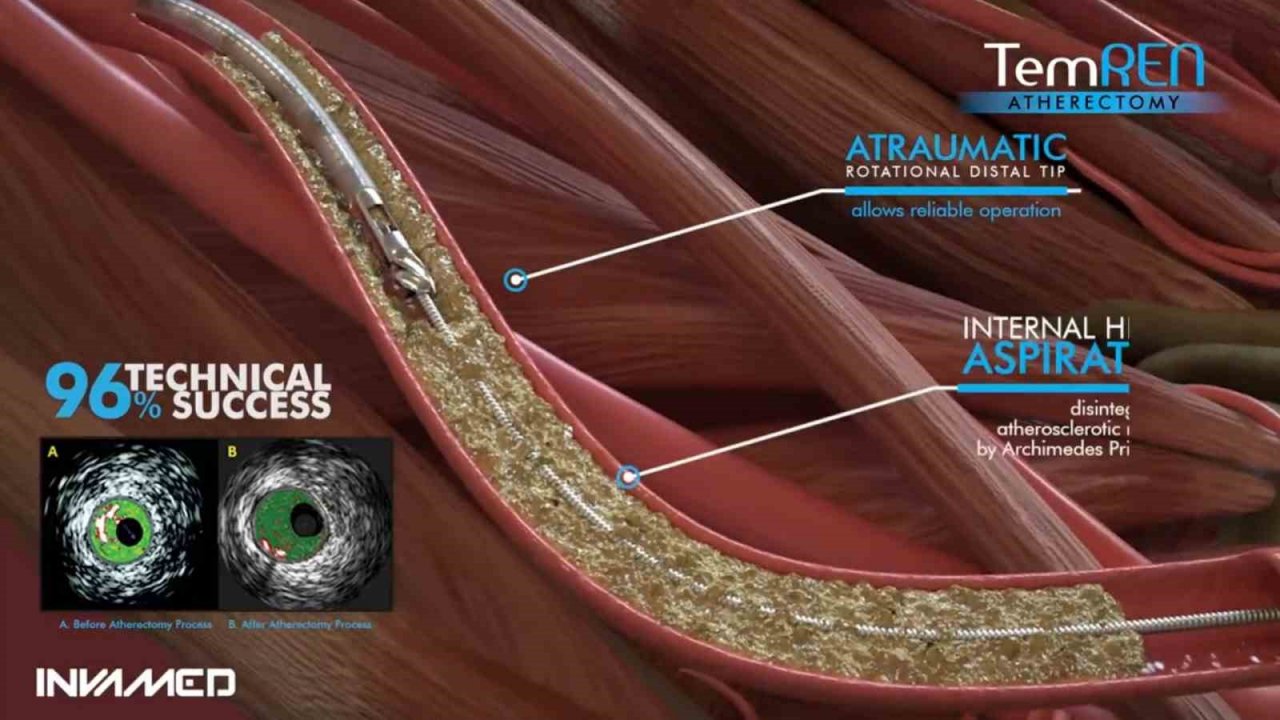 INVAMED’den tıbbi cihaz sektöründe yapay zeka ve uzaktan bağlantı teknolojisi