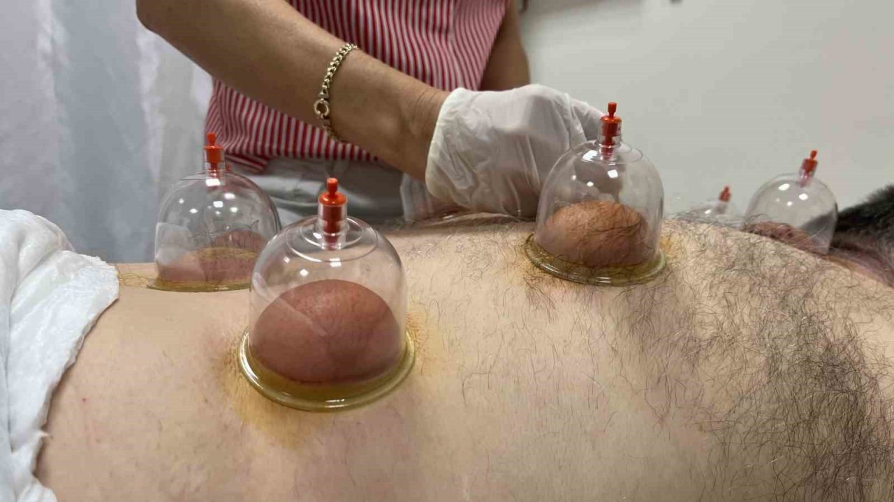 Hastalar GETAT ünitesinde ozon terapi, hacamat, kupa tedavisi ve mezoterapi ile şifa buluyor