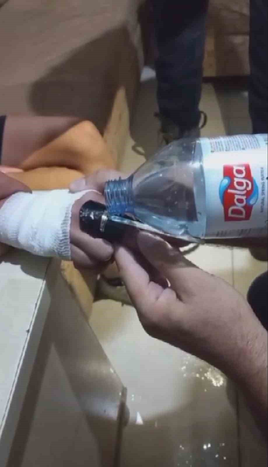 Yüzüğü parmağına sıkışan çocuğun yardımına itfaiye yetişti