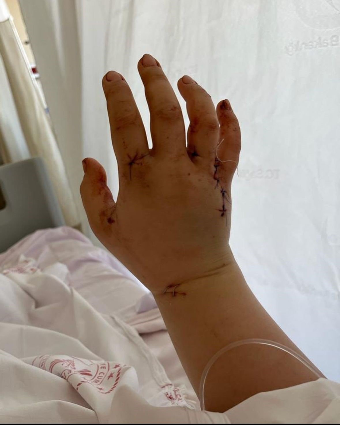 Eşi tarafından 32 yerinden bıçaklanan fenomenden paylaşım