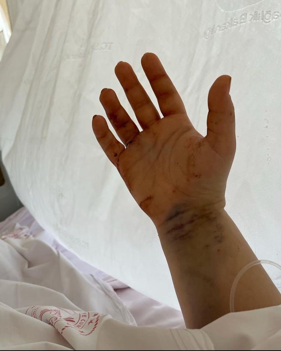 Eşi tarafından 32 yerinden bıçaklanan fenomenden paylaşım