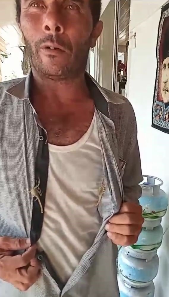 Akreplere kendini sokturdu, ‘Hayvan sevgisi’ dedi