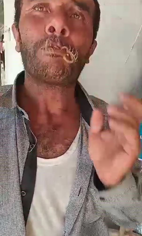 Akreplere kendini sokturdu, ‘Hayvan sevgisi’ dedi