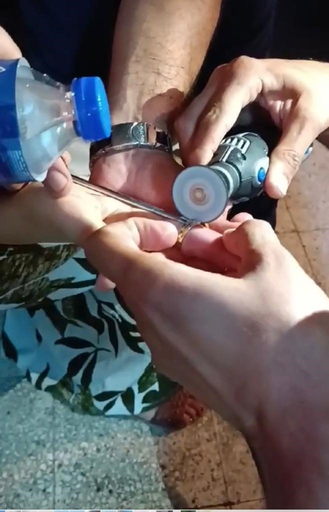 Parmağına yüzük sıkışınca itfaiye ekipleri yardımına yetişti