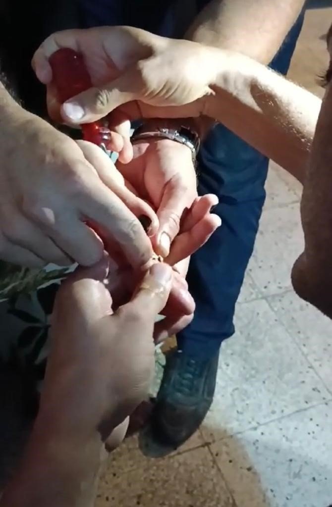 Parmağına yüzük sıkışınca itfaiye ekipleri yardımına yetişti