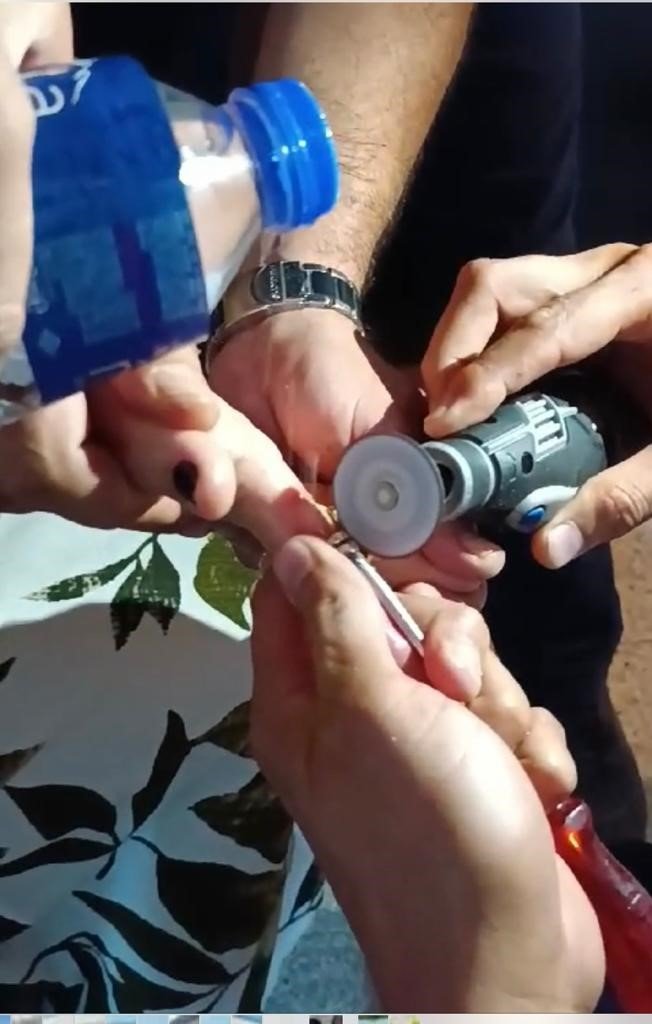 Parmağına yüzük sıkışınca itfaiye ekipleri yardımına yetişti