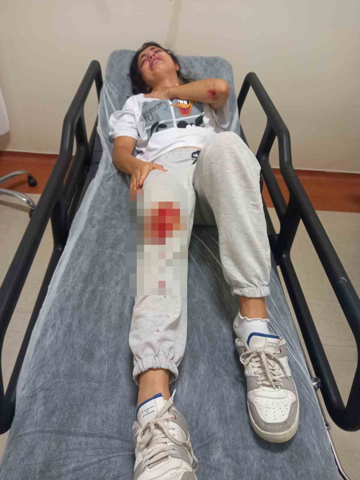 Köpeklerin saldırdığı genç kadın ölümden döndü: O onları gözyaşlarıyla anlattı