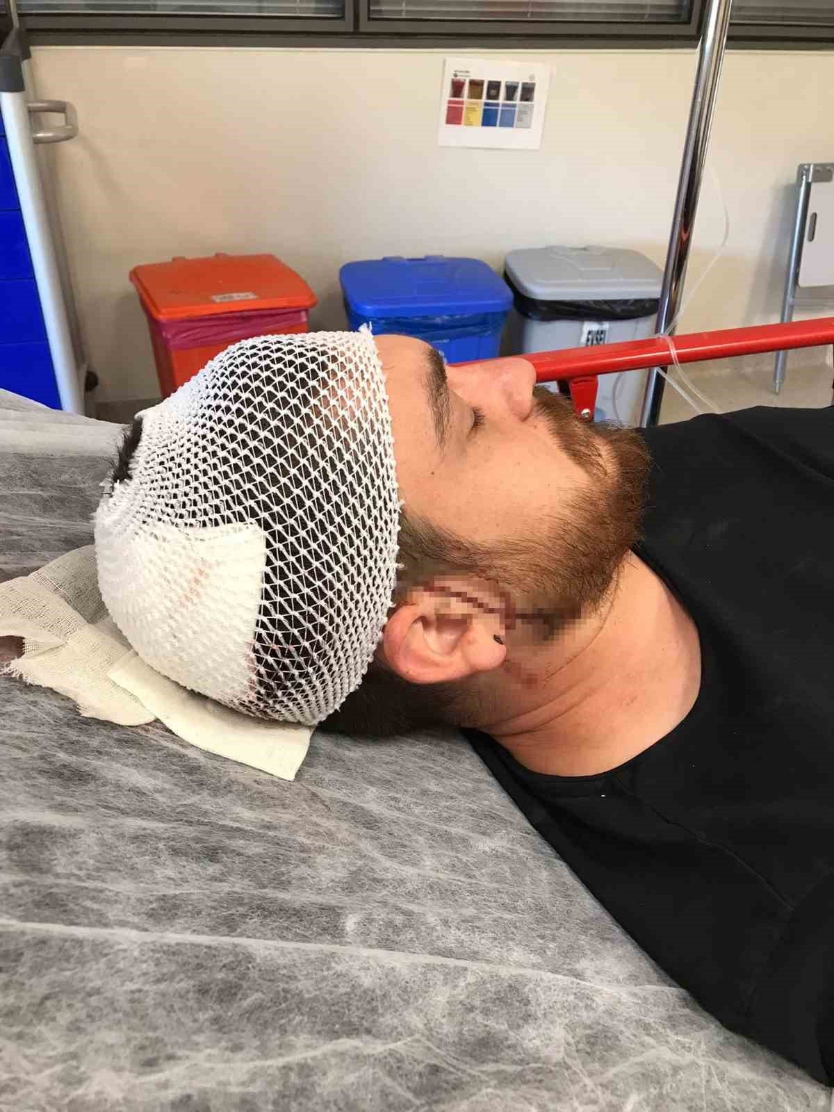 Trafikte tartıştığı sürücünün başına çekiçle vurdu