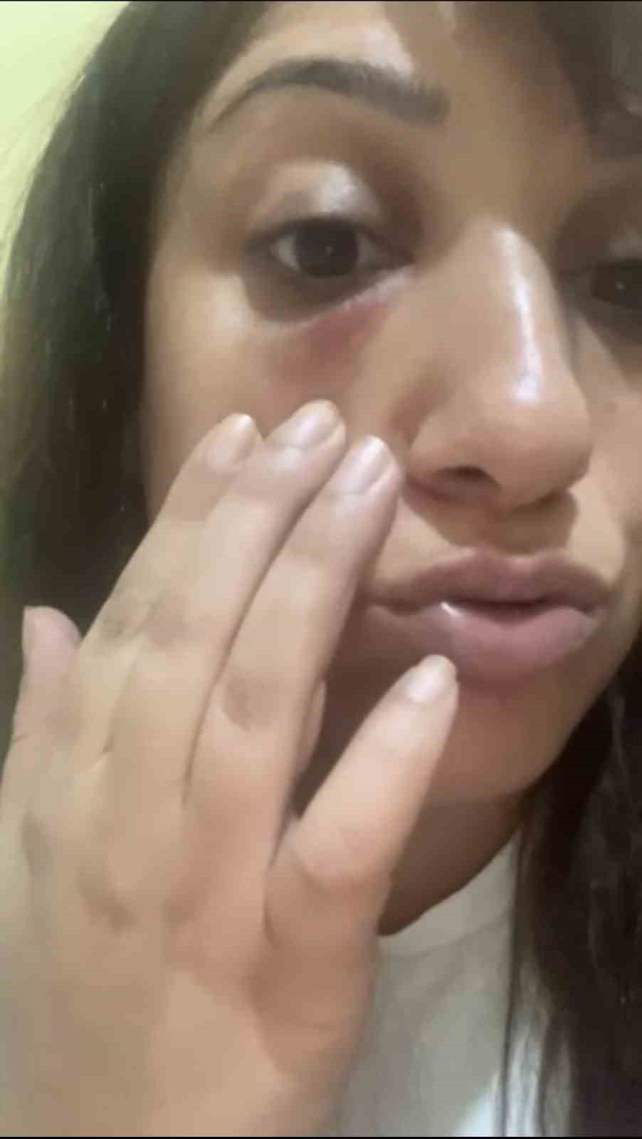 Taksim’de hastanede doktor dehşeti kamerada: Kadının gözüne yumruk attı