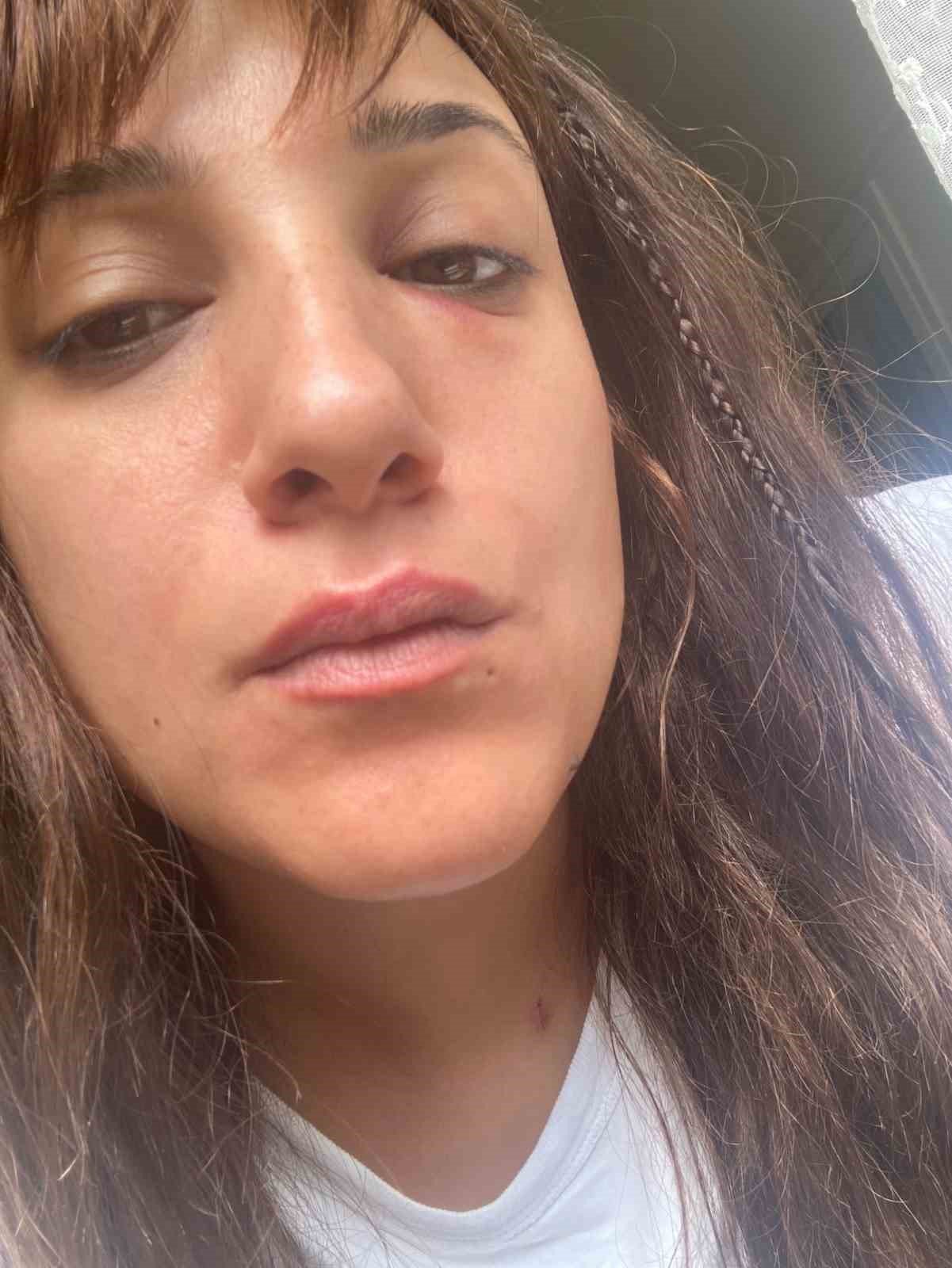 Taksim’de hastanede doktor dehşeti kamerada: Kadının gözüne yumruk attı