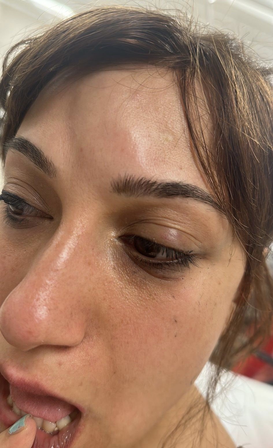 Taksim’de hastanede doktor dehşeti kamerada: Kadının gözüne yumruk attı