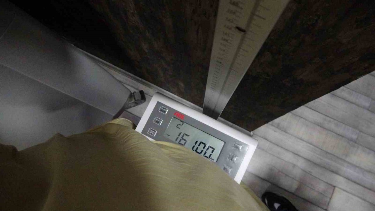 Geçirdiği trafik kazası sonrası tedavi sürecinde 191 kiloya ulaştı, ardından obezite tedavisi ile 2 ayda 32 kilo verdi