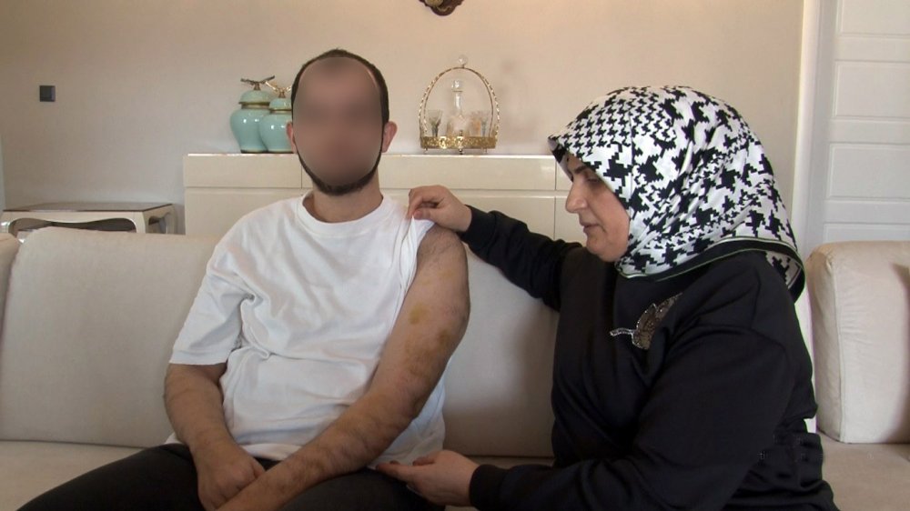 Rehabilitasyon Merkezinde Skandal: Otizmli Öğrenciyi Darp Eden Öğretmen Tutuklandı