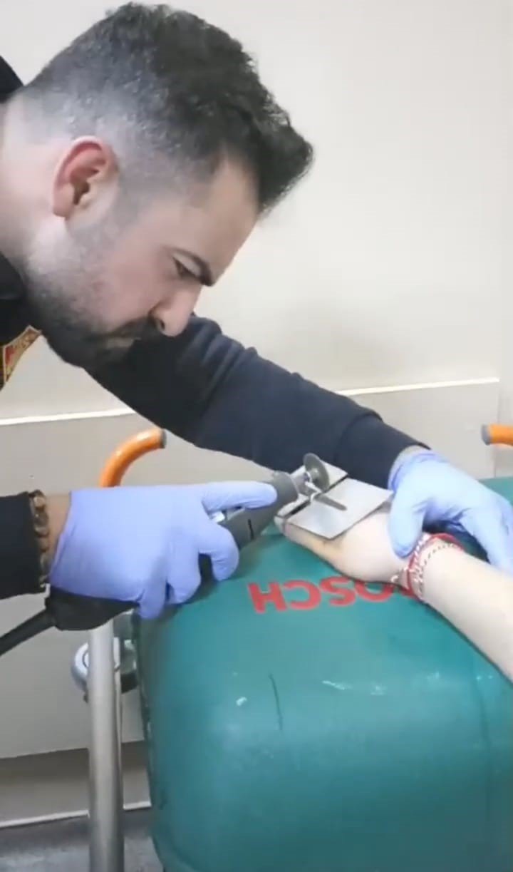 Genç kızın parmağına sıkışan yüzüğü itfaiye çıkardı